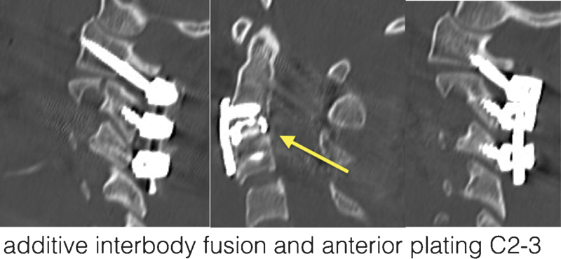 Fig. 13