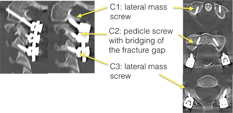 Fig. 12