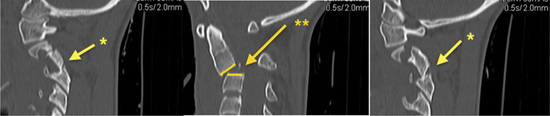 Fig. 10