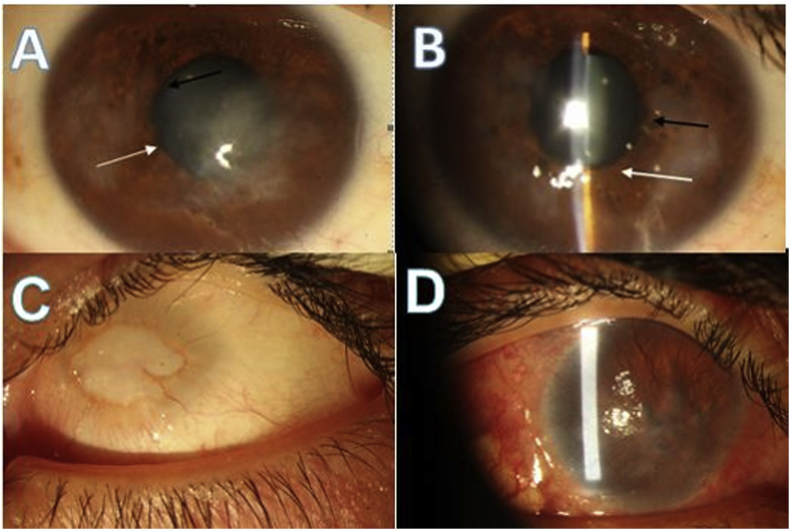 Fig. 3