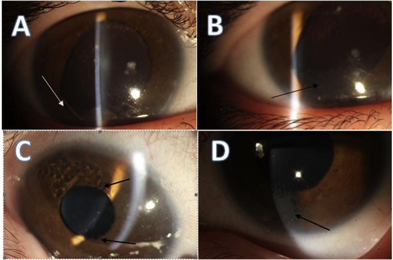 Fig. 2