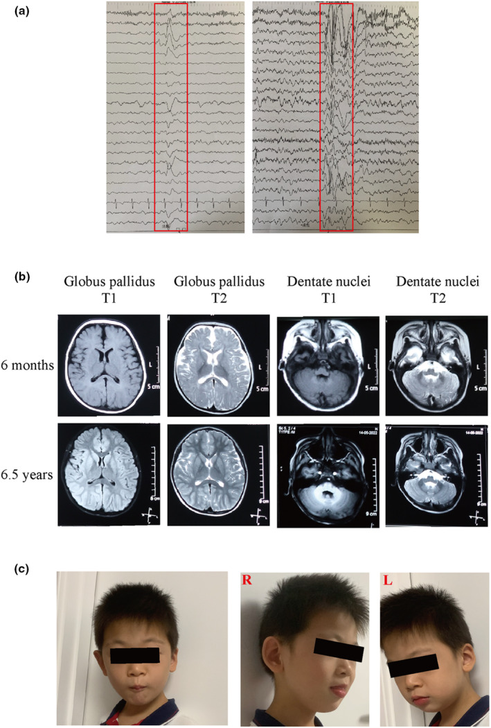 FIGURE 1