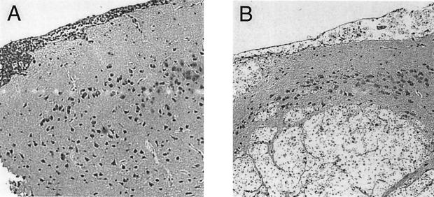 FIG. 9