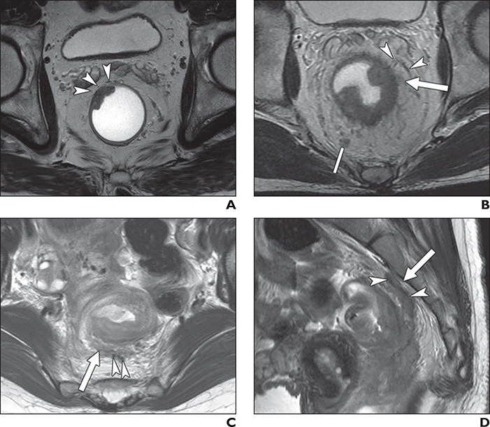 Fig. 1—