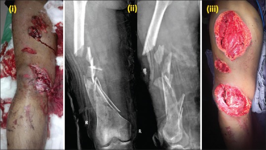 Figure 18