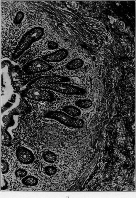 Fig. 19