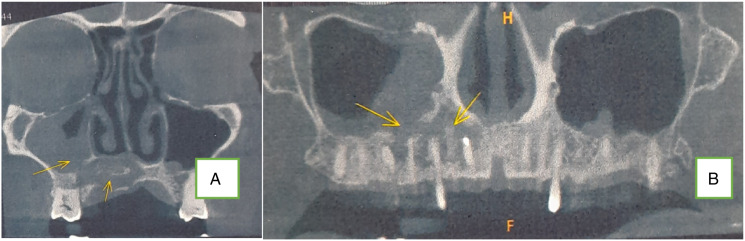 Figure 12.