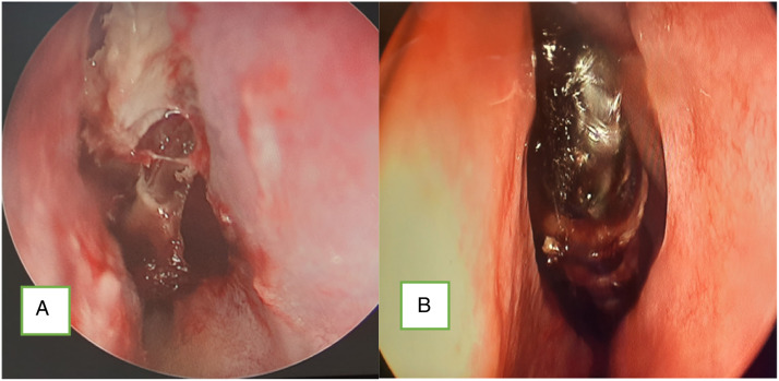 Figure 4.