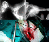 Fig 4