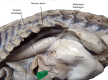 Fig 9