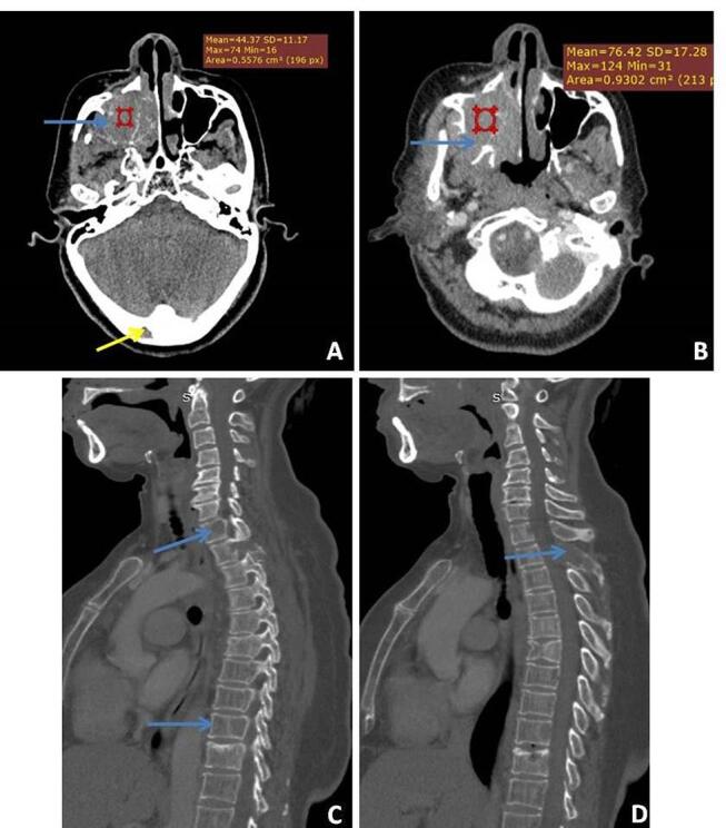 Fig. 16