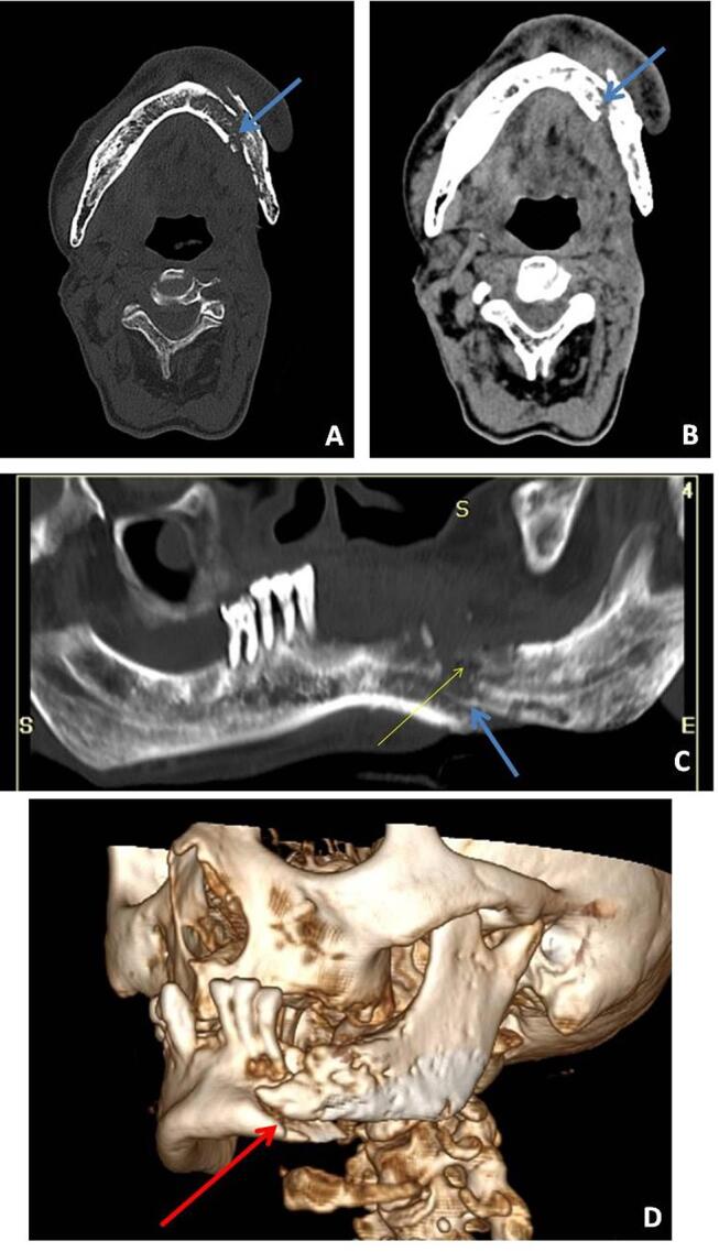 Fig. 13