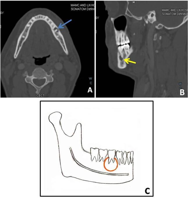 Fig. 3