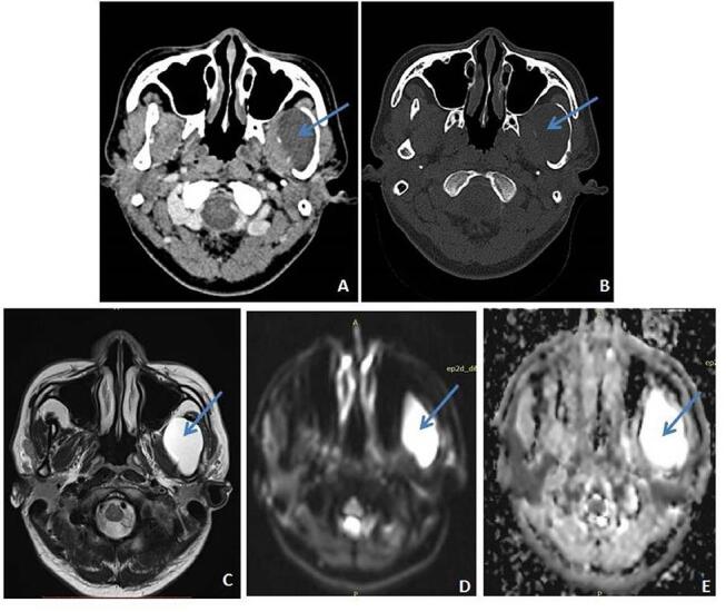 Fig. 9