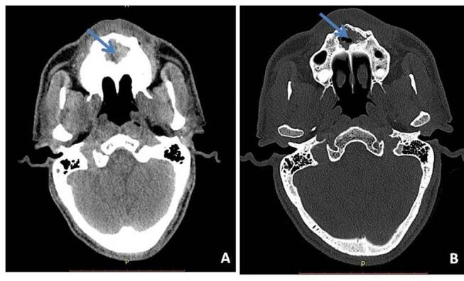 Fig. 12