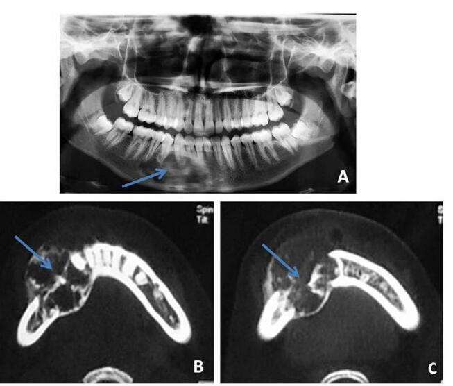 Fig. 10