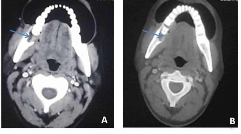 Fig. 14