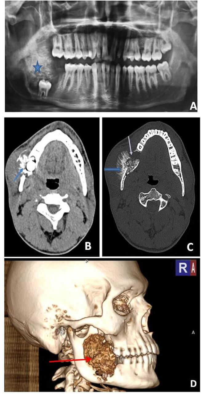 Fig. 17