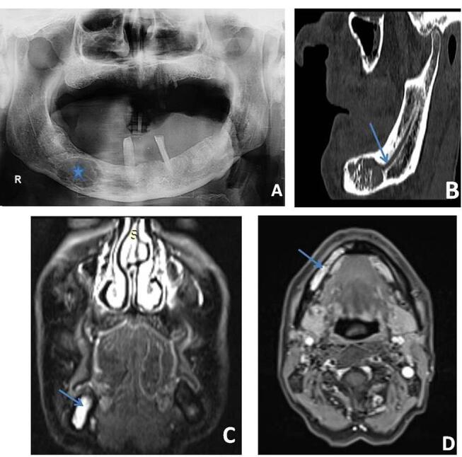 Fig. 11