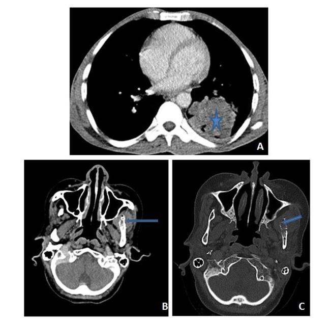 Fig. 15