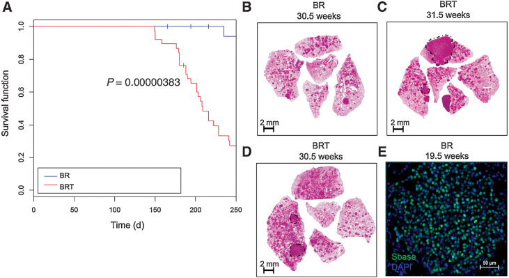 Figure 1. The Sleeping Beauty (SB) transposon system promotes lethal malignant progression of BRAFV600E-driven lung tumors in a GEM model. A, Kaplan–Meier survival curve tracking survival of 50 BrafCA and SB (CAGG/R26LSL-SB11) or (BR) mice, either with or without a T2/Onc2 transposon or (BRT) mice donor on chromosome 4 (C4T2/Onc2) for 250 days. Mice were initiated through intranasal instillation with 106 pfu of Ad5.CMV-CRE. Statistical analysis was performed using a log-rank Mantel–Cox test where P = 0.00000383. B–D, Histological analyses of formalin-fixed paraffin-embedded (FFPE) tumor-bearing lung sections stained with hematoxylin and eosin (H&E). E, Expression of SB transposase in BR mouse lung tumors at 19.5 weeks after initiation assessed by immunofluorescence analysis of FFPE sections of mouse lungs. DAPI-stained DNA is blue and SB11 Transposase is in green.