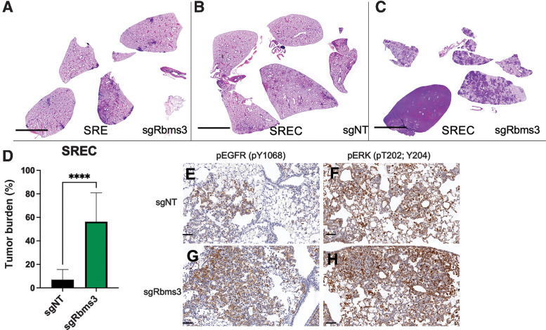 Figure 5. Rbms3 loss cooperates with EGFRL858R to accelerate malignant lung adenocarcinoma. A–C, Images of harvested mouse lung sections following necropsy analyses stained with hematoxylin and eosin (H&E) 11 weeks after initiation with 1×105 pfu lenti-CRE, followed by continuous administration of doxycycline chow to induce EGFRL858R expression. CRISPR/CAS9-mediated genome editing was used in B and C to edit Rbms3 in vivo. Genotype of each experimental group was: A, sgRbms3-CRE virus in SPC::CRE-ERT2/+; Rosa26CAGs-LSL-rTTa3; EGFRL858R (SRE) mice. B, sgNT-CRE virus in or SPC::CRE-ERT2/+; Rosa26CAGs-LSL-rTTa3; EGFRL858R; H11LSL-CAS9/+ (SREC) mice. C, sgRbms3-CRE virus in SREC mice. Black bar in bottom left of each panel represents a 1,000 μm, scale bar. D, Quantification of tumor burden from genotypes in B compared with C. N = 5 mice per group. The mean is graphed, and error bars represent SEM. Statistical analysis was conducted using a paired t test; ****, P < 0.0001. E, Representative images of IHC on FFPE lung tissue sections from SREC mice initiated with either sgNT- or sgRbms3-CRE and stained with pEGFR (pY1068) or pERK (pT202; Y204) shown at ×20 magnification. Scale bar shown in black at the bottom left corner of each image represents 50 μm.