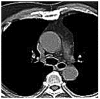 Figure 11.
