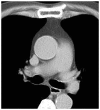 Figure 12.
