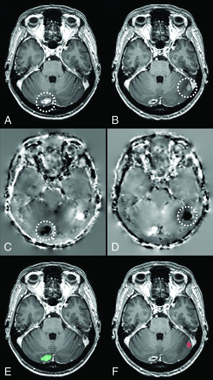 Fig 2.