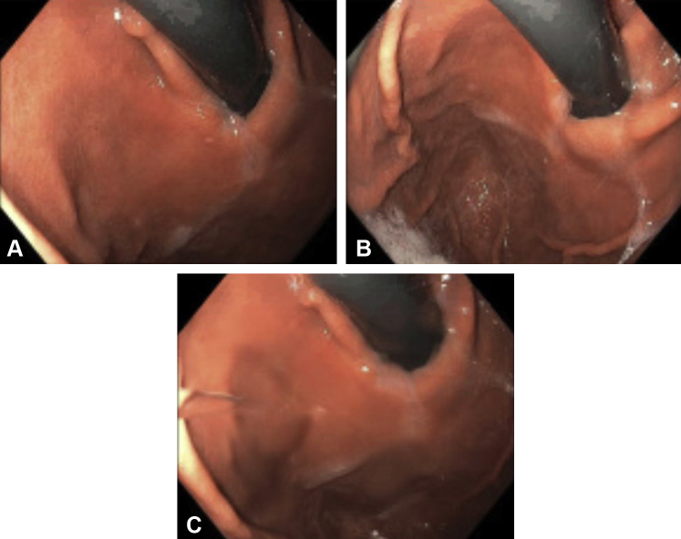 Figure 5