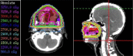 Fig. 6