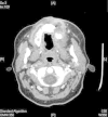 Fig. 3
