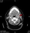 Fig. 1