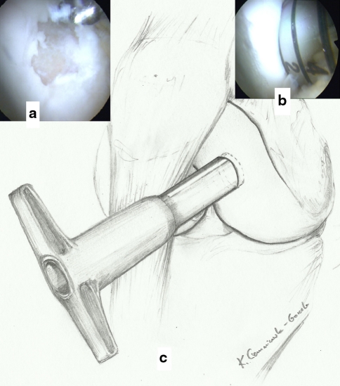 Fig. 1