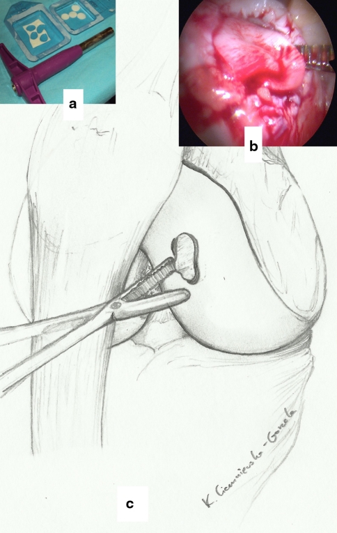 Fig. 2