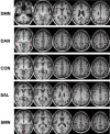 <b>FIG. 1.</b>