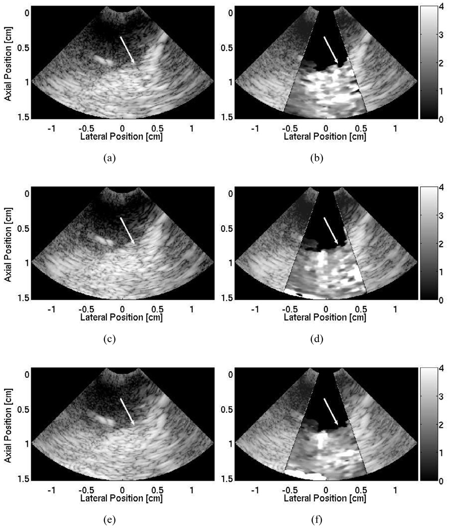 Fig. 11