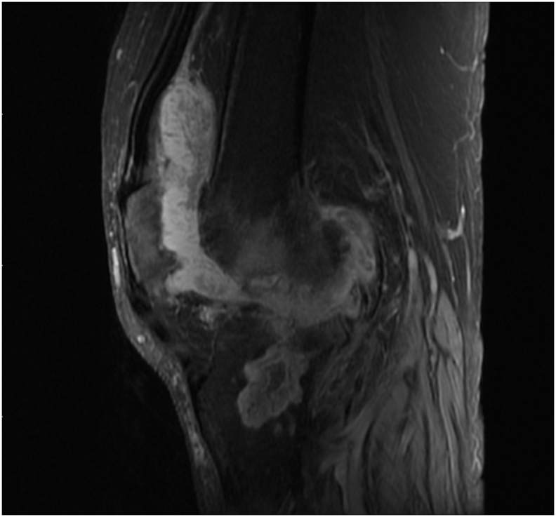 Fig. 1E