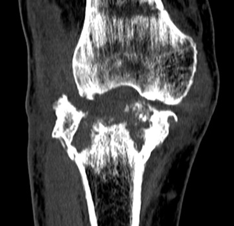 Fig. 1C