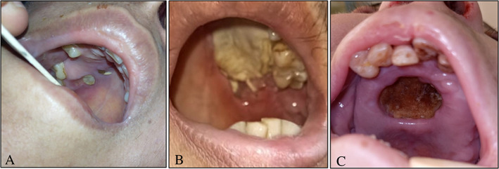 Fig 1