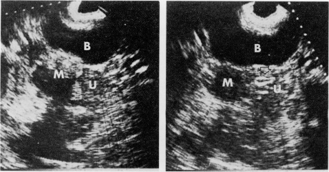 FIG. 7