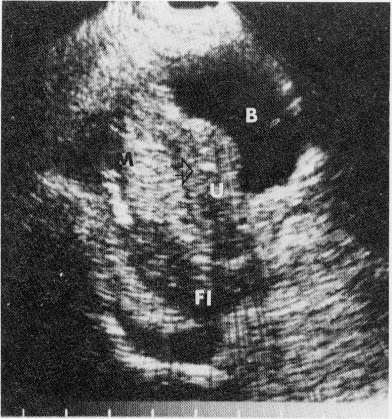 FIG. 8