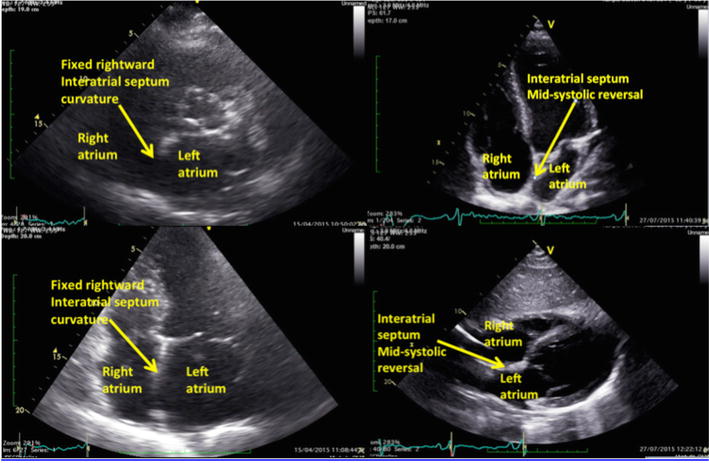 Fig. 4