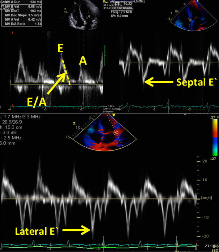 Fig. 3