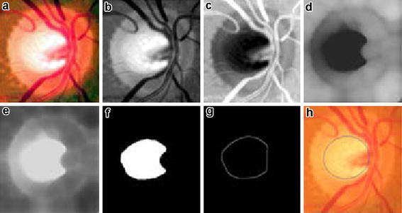 Fig. 4