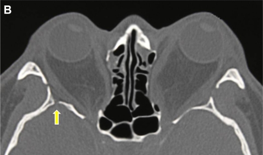 Figure 1B