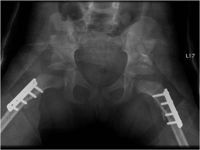 graphic file with name jbjsest-3-e19-g029.jpg