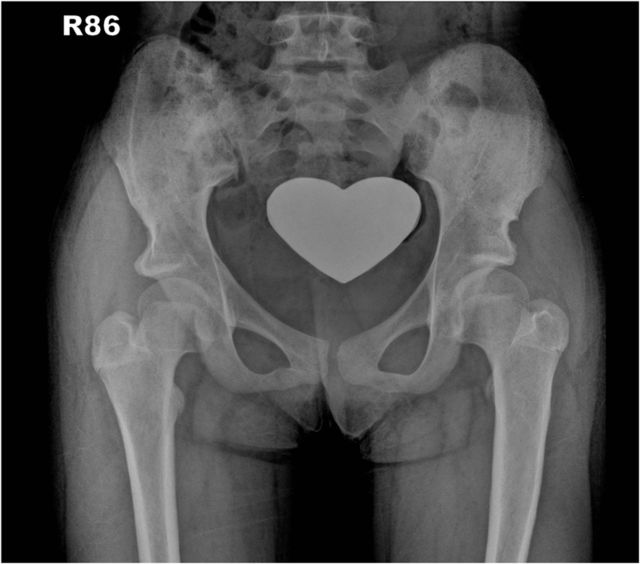 graphic file with name jbjsest-3-e19-g034.jpg