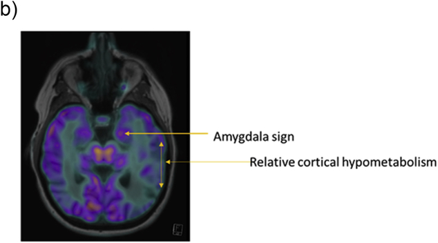 Fig. 1b.