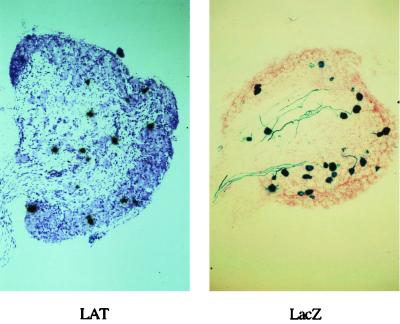 FIG. 11